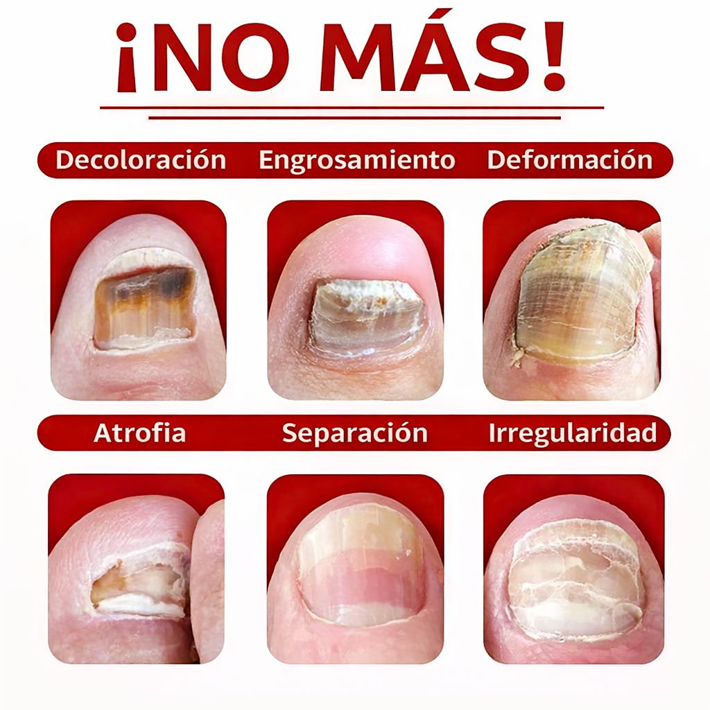 Nail Detox 7