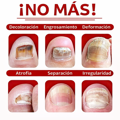 Nail Detox 7