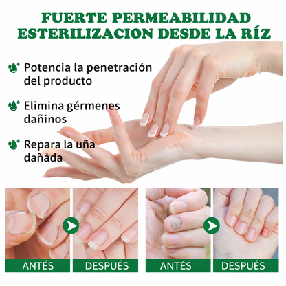 Nail Detox 7