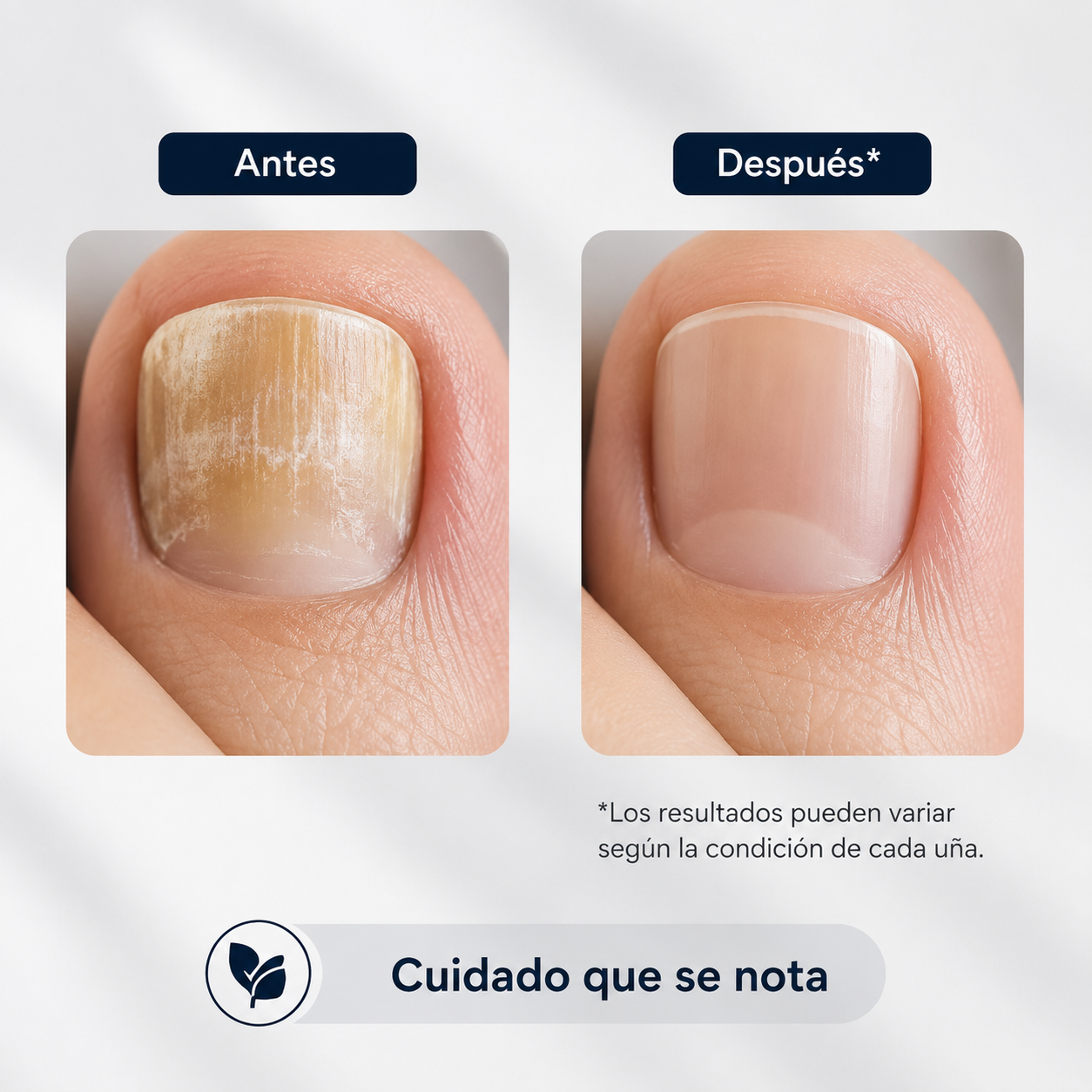PureNail Rx™ x3