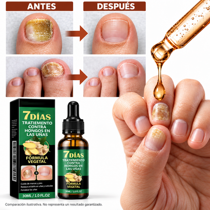 Nail Detox7™ — Kit Dúo para el Cuidado de las Uñas.